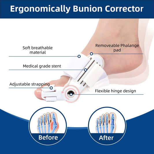 Fewener Bunion Corrector Kit for Women, Bunion Toe Separators & Adjustable Orthopedic Bunion Splint for Pain Relief