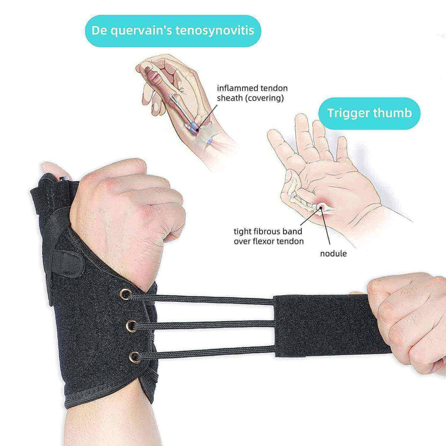 wrist thumb spica splint, hand brace for de Quervain's tenosynovitis, the targeted illness